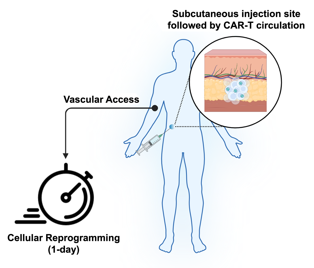 rPOC Subcutaneous platform